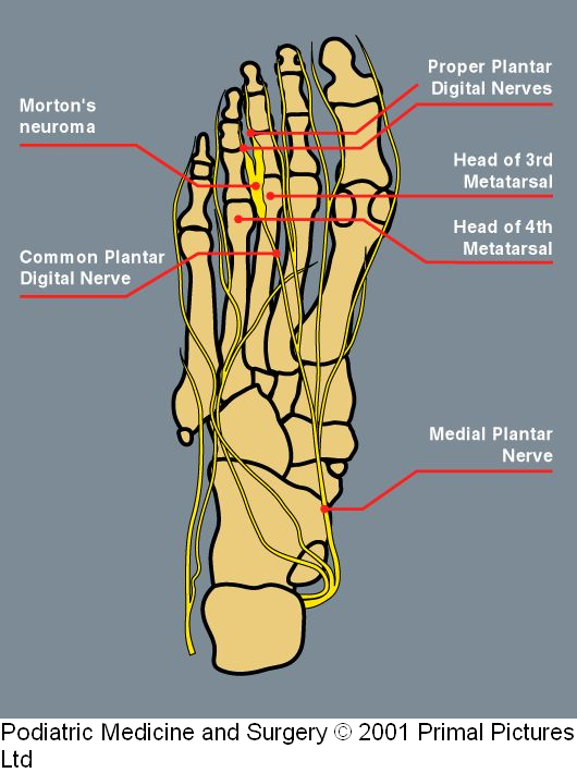 Foothills Foot Care Podiatry Greenville Greer SC Foot Surgeon, Surgery